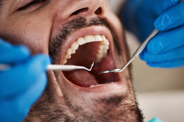 Best Dentist for Dental Trauma  in Goldsby, OK